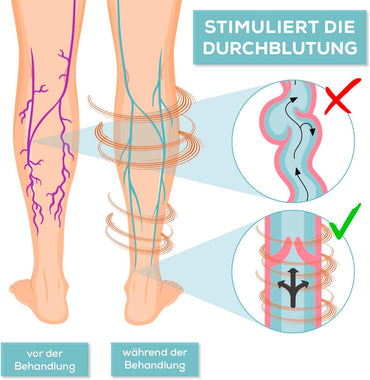 VENENWALKER Circulation Stimulator + Remote Control