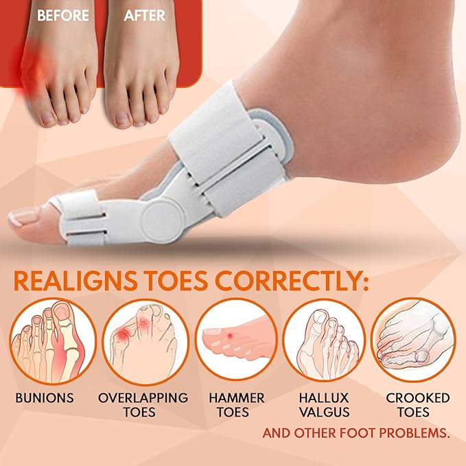 Bunion Corrector & Advanced Hallux Valgus Toe Splint for Effective Pain Relief & Natural Toe Alignment