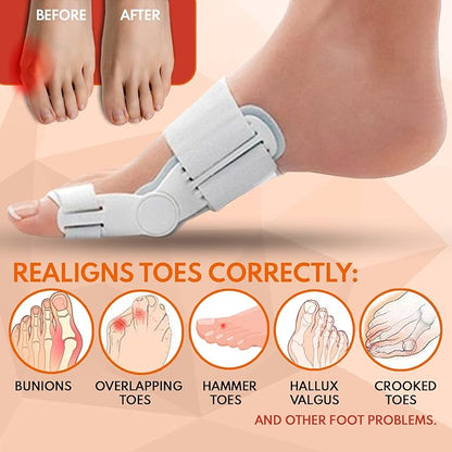 Bunion Corrector & Advanced Hallux Valgus Toe Splint for Effective Pain Relief & Natural Toe Alignment